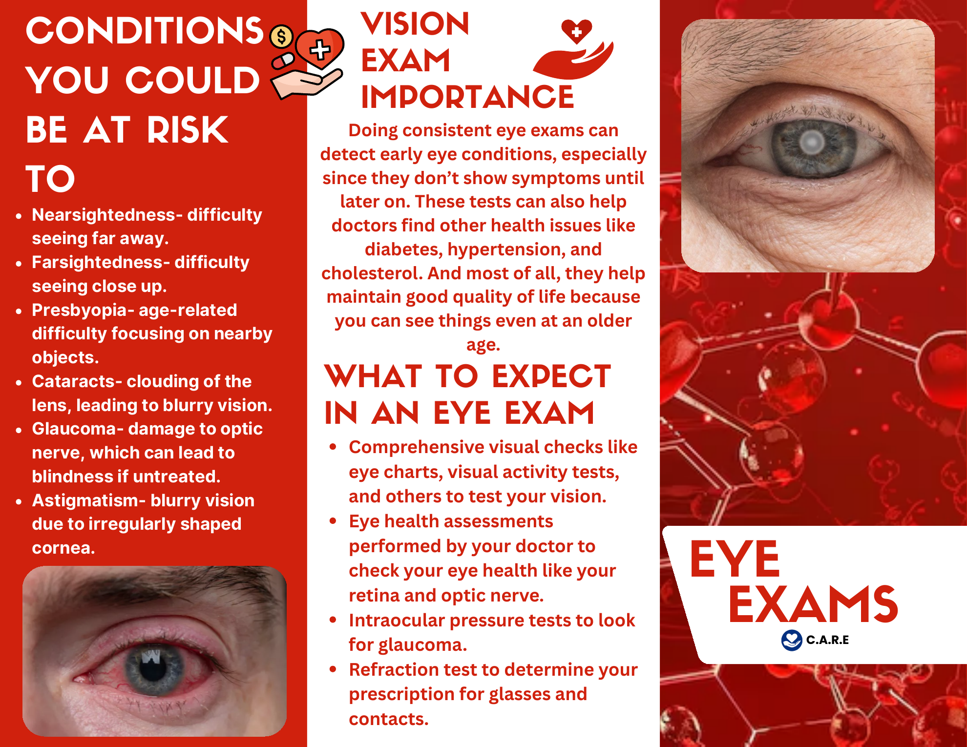 Eye Symptoms Handout preview